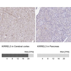 Kirrel3/NEPH2 Antibody, Novus Biologicals 25 &mu;L, Unlabeled:Antibodies,